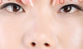 上眼睑下垂恢复锻炼法 上眼睑下垂恢复锻炼法